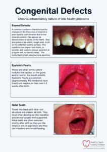 Infographic on congenital oral health defects.